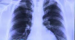 Radiografie